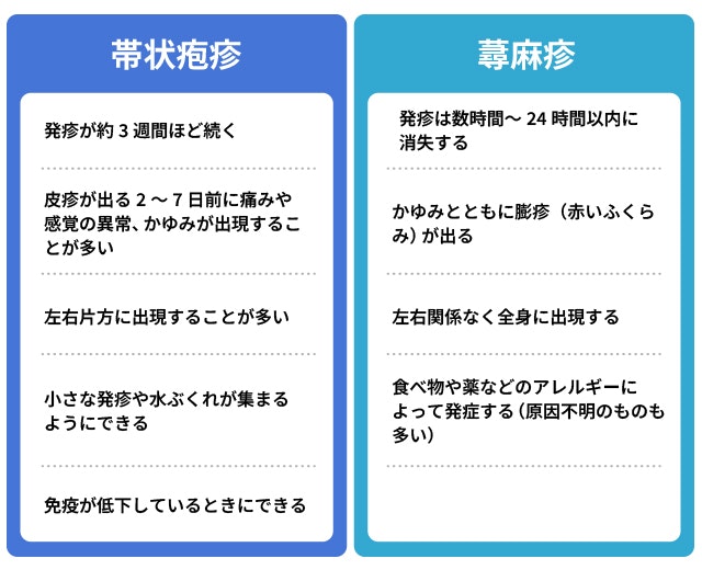 帯状疱疹と蕁麻疹の見分け方の表