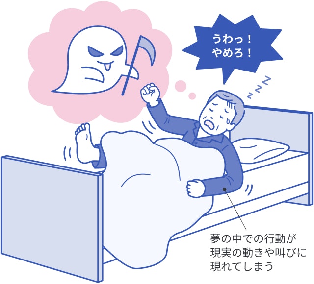 レム睡眠行動障害を説明する図です