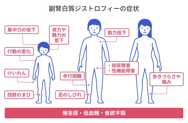 副腎白質ジストロフィーの症状を説明する図です