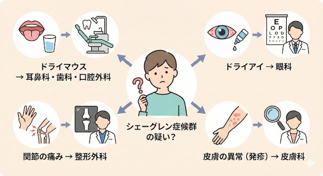 シェーグレン症候群の疑いがある際、症状ごとに受診すべき診療科を示したフローチャート。ドライアイは眼科、ドライマウスは歯科・耳鼻科、関節痛は整形外科など、適切な相談先を分類したイラスト。