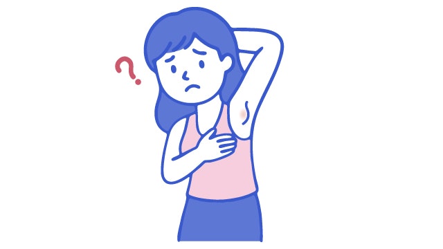 乳がんの転移を説明する図です