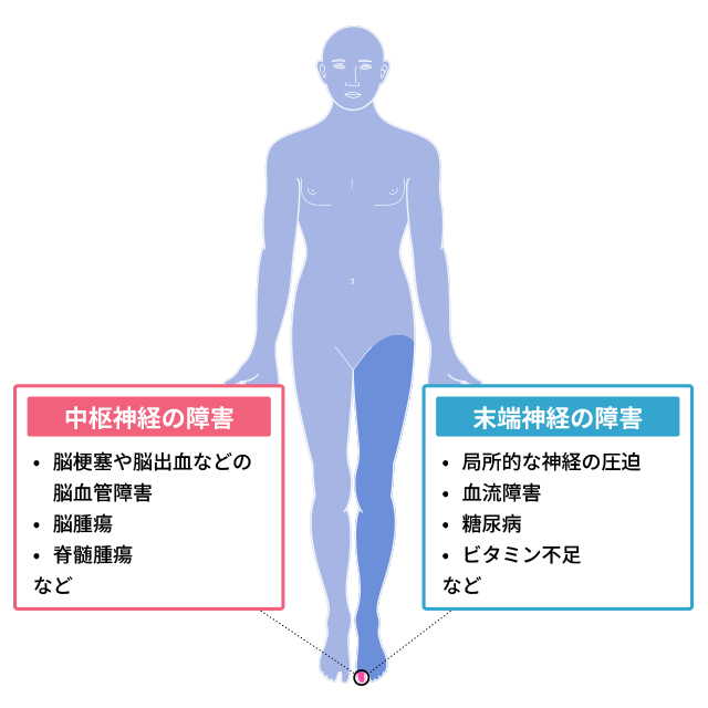 靴 小指 しびれ コレクション