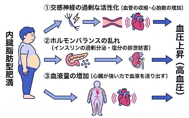 肥満症において、特に内臓脂肪型肥満が高血圧を引き起こす仕組みを、交感神経の過剰な活性化、ホルモンバランスの乱れ、血液量の増加という3つの要因から、心臓や血管のアイコンを交えて解説した図です。