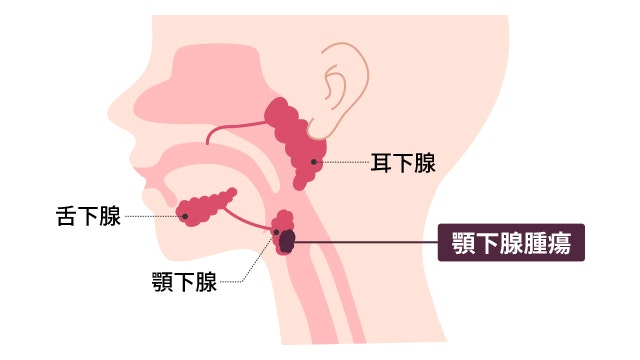 顎下腺の位置がわかるイラスト