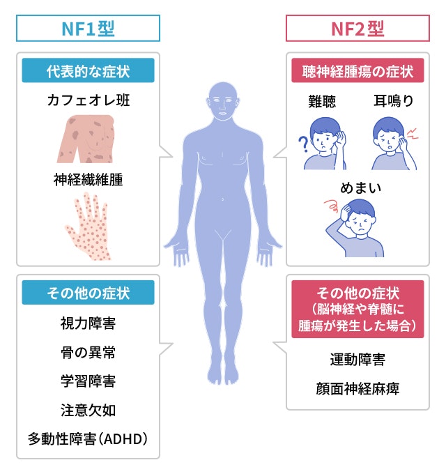 神経線維腫症の症状をを説明する図です