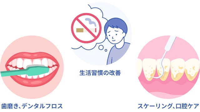 口臭予防を説明する図です