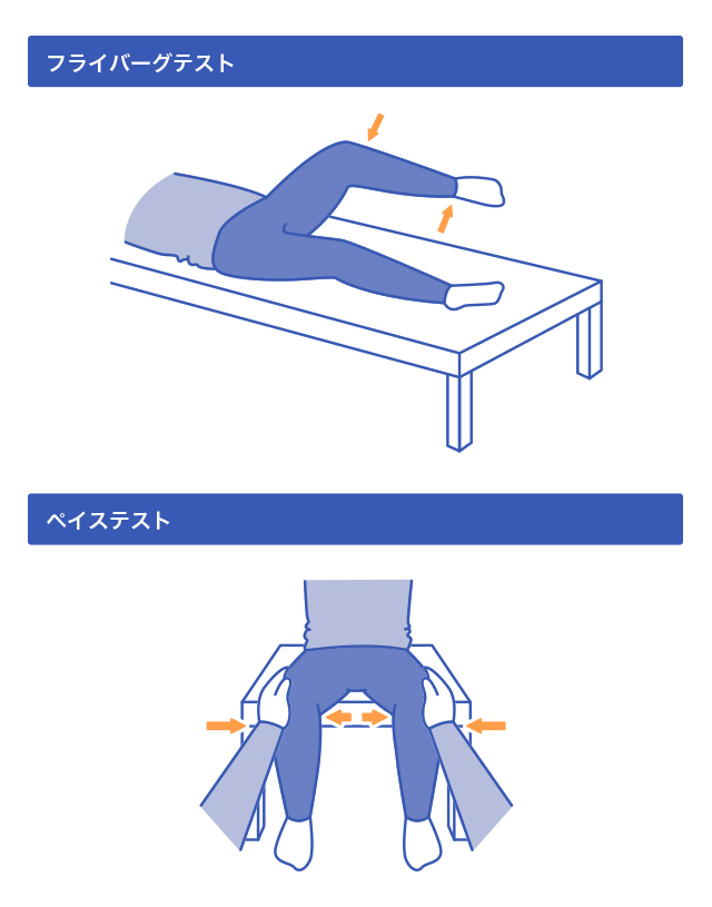 梨状筋症候群かどうか確かめる方法はありますか？ ｜梨状筋症候群