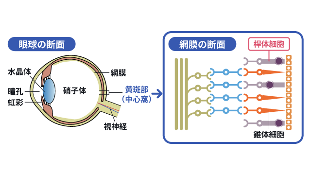 夜盲症の原因や考えられる病気を説明する図です