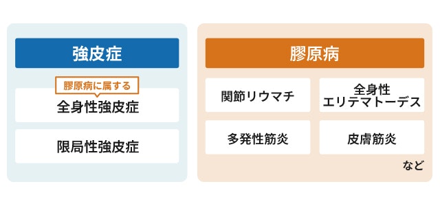 強皮症と膠原病の違いがわかるイラスト