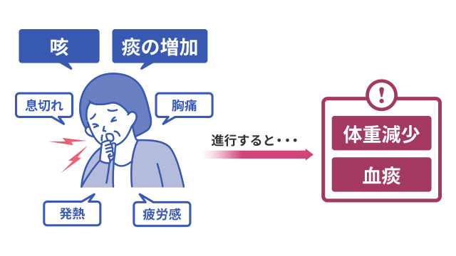 肺MAC症ではどのような症状がありますか？ ｜肺MAC症