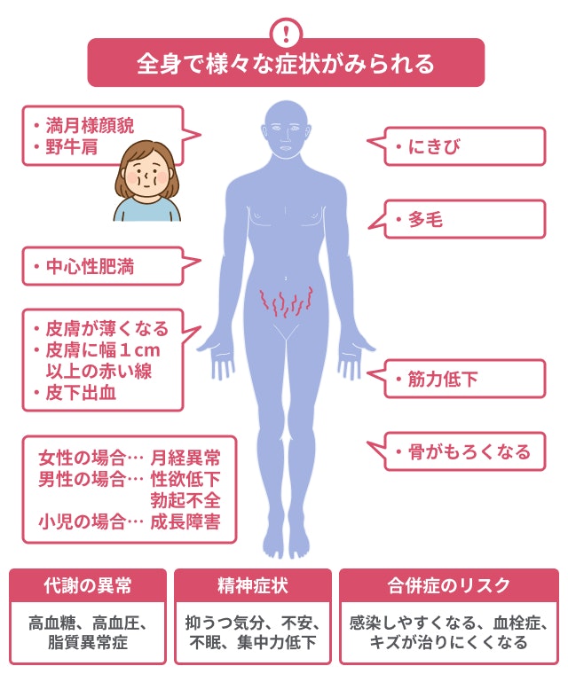 クッシング病の症状を説明する図です