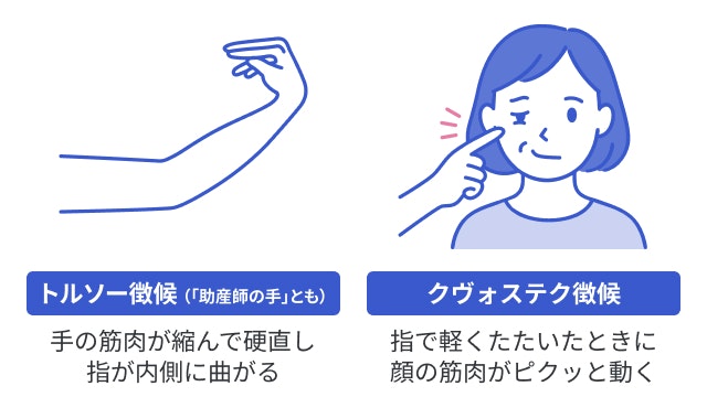 テタニーに特有の所見を説明する図です