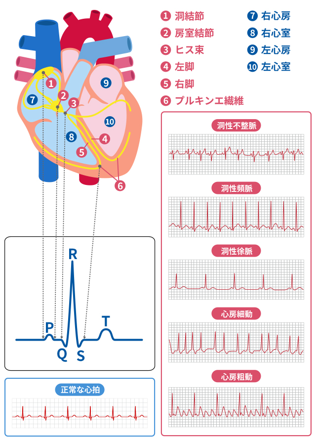 心電図の波形のイラスト