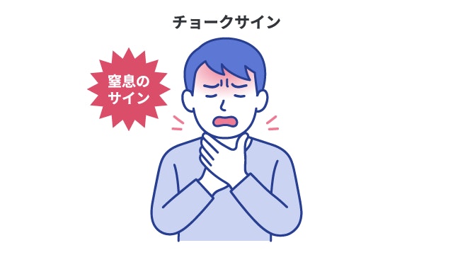 窒息(気道閉塞)において、救助を求める世界共通のサインである「チョークサイン」を示すイラスト。呼吸ができず声が出せない人が、親指と人差指で喉を掴む特有の仕草と苦悶の表情を描写しています。