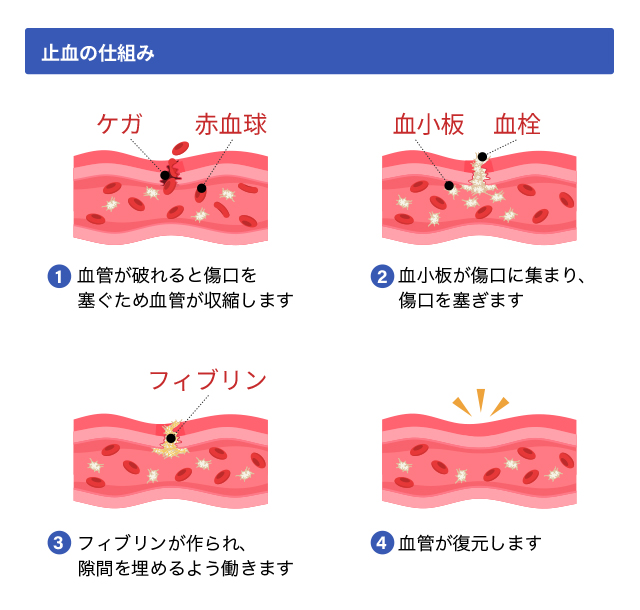 みんなの血液内科学 イラストで理解する みんなの血液内科学 | 渡邉 純一 |本 | 通販 |