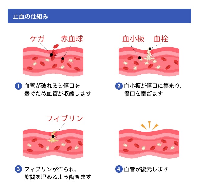 血液凝固の仕組みを説明する図です