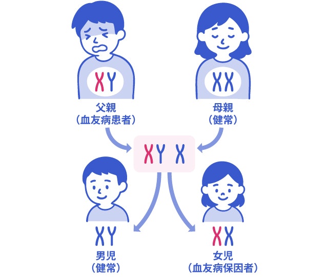 血友病の遺伝子が子供に受け継がれる確率を説明する図です