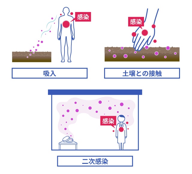 コクシジオイデス症の主な感染経路のイラスト