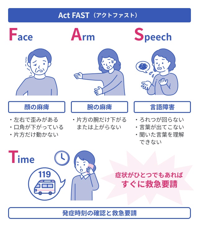 Act FASTを説明する図です