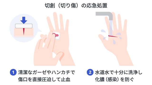 切創(切り傷)の応急処置の手順を示す解説イラスト。清潔なガーゼで傷口を強く押さえる直接圧迫止血法と、感染予防のために水道水の流水で傷口を十分に洗浄する様子を描いています。