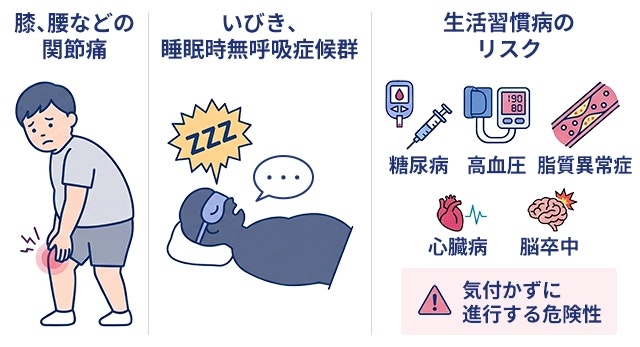 肥満（単純性肥満）による主な症状として、膝や腰の関節痛、いびきや睡眠時無呼吸症候群の様子と、糖尿病や高血圧など気づかずに進行する生活習慣病のリスクが高まる状態を解説したイラストです。