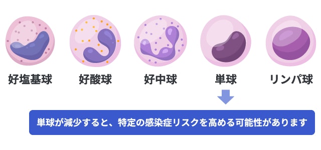 白血球を構成する5種類の細胞(好塩基球・好酸球・好中球・単球・リンパ球)のイラスト。単球が減少すると、特定の感染症リスクを高める可能性があることを解説。