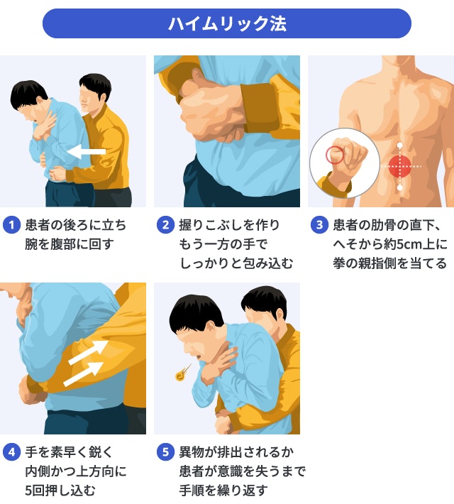 窒息時の異物除去法であるハイムリック法(腹部突き上げ法)の正しい手順を示す解説図。救助者が背後から患者のへそ上部に握り拳を当て、内側かつ上方へ素早く突き上げる動作を5段階で詳細に描写しています。