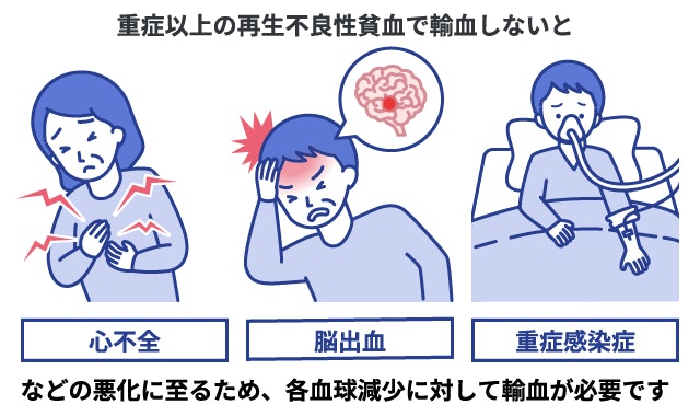 重症以上の再生不良性貧血で輸血治療を行わない場合に起こる重篤な合併症3つのイラスト。赤血球減少による「心不全」、血小板減少による「脳出血」、白血球減少による「重症感染症」への悪化リスクを提示し、各血球減少に対する輸血の必要性を解説。