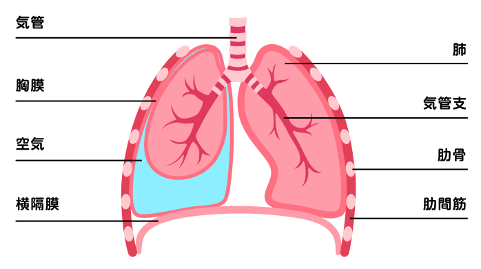 気胸」とはどのような病気ですか？ ｜気胸