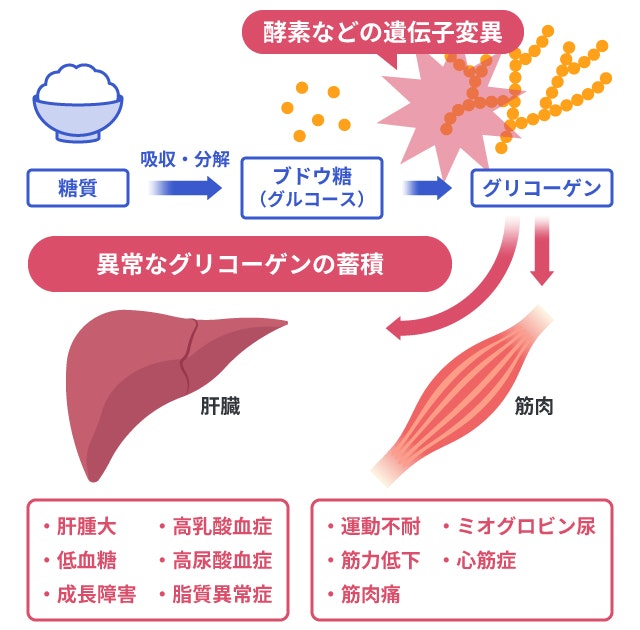 糖原病を説明する図です