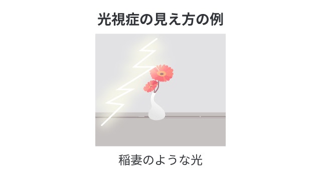 光視症の症状について説明する図です