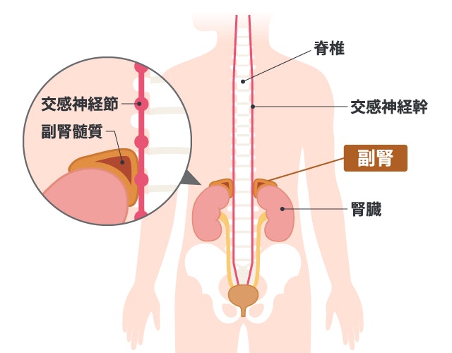 神経芽腫は体のどこにできるか説明する図です
