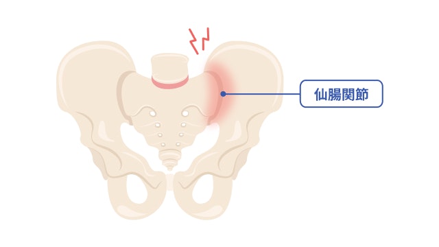 仙腸関節を説明する図です