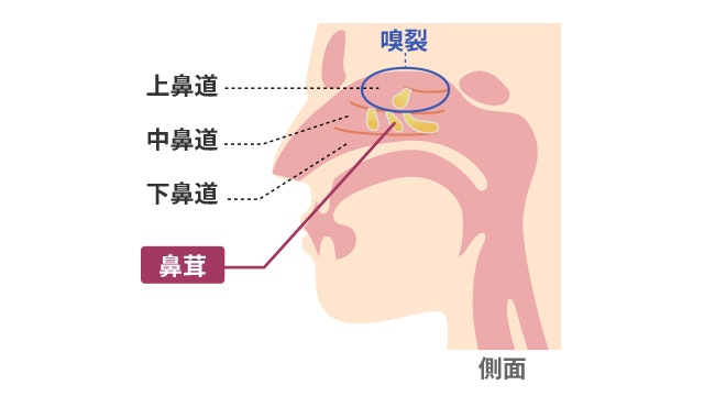 鼻茸ができる位置のイラスト