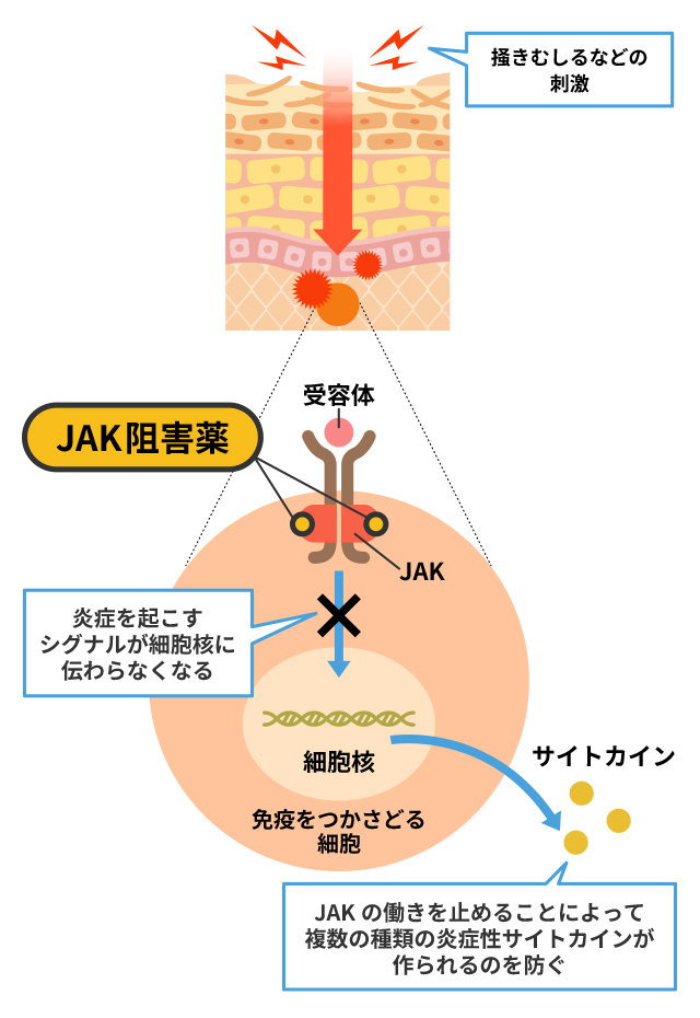 jak阻害薬のイラスト