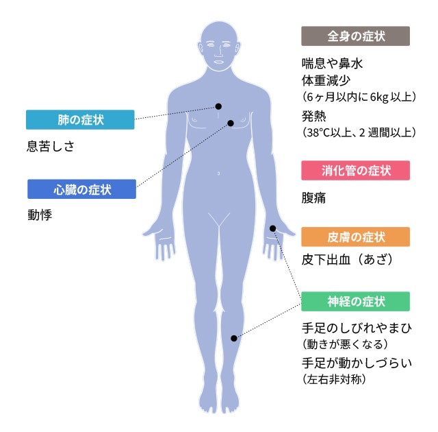 好酸球性多発血管炎性肉芽腫症の症状について説明する図です