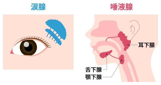 シェーグレン症候群で炎症が起こる主な分泌腺の位置を示した解剖図。目の上の涙腺と、耳の下や顎にある唾液腺（耳下腺・顎下腺・舌下腺）の場所を特定し、自己免疫反応の標的部位を解説。