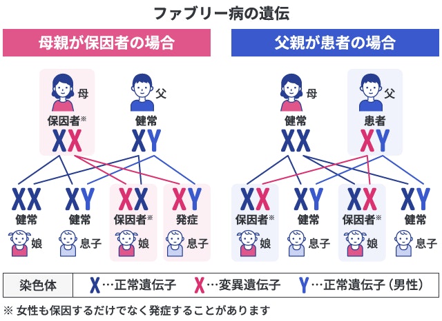 ファブリー病の遺伝形式（X連鎖性潜性遺伝）のパターン図。母親が保因者の場合（息子・娘それぞれに50%の確率で遺伝）と、父親が患者の場合（娘は100%保因者となり、息子には遺伝しない）を家系図と性染色体（XX・XY）で解説。