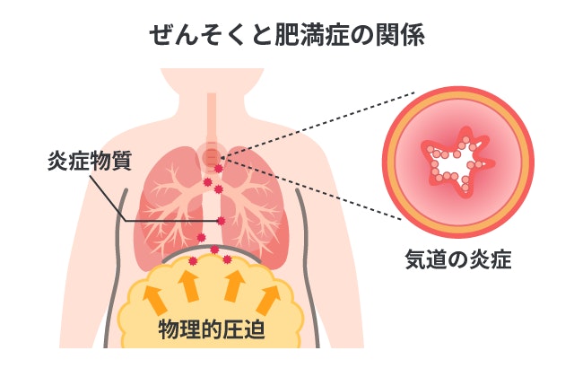 肥満症がぜんそくを治りにくくさせる関係性を、内臓脂肪による肺への物理的な圧迫と、脂肪から分泌される炎症物質によって気道の炎症が悪化する様子を簡単な解剖図で説明するイラストです。