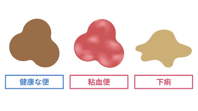 粘血便を説明する図です