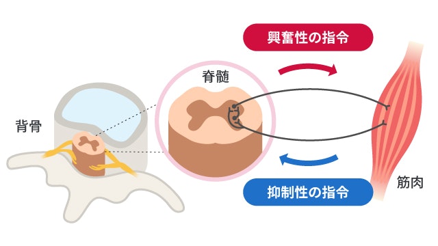 痙縮のメカニズムを説明する図です