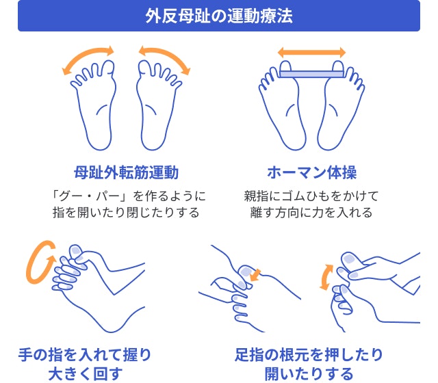 外反母趾の運動療法を説明する図です