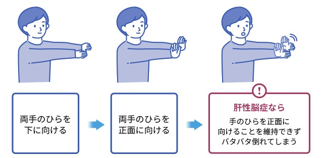 羽ばたき振戦テストの図