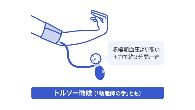 テタニーのトルソー徴候を説明する図です