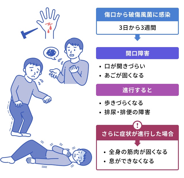 破傷風を説明する図です