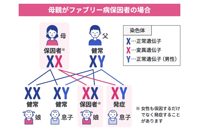 父親が健常で、母親がファブリー病の保因者である場合の遺伝確率を性染色体（XX・XY）で示すパターン図。生まれてくる息子は50%の確率で発症し、娘は50%の確率で保因者となるX連鎖性遺伝の仕組みを図解。
