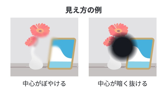 黄斑ジストロフィーの見え方について説明する図です