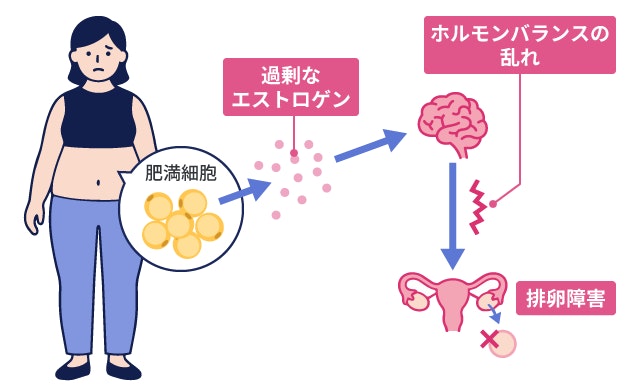 肥満症による月経異常や不妊のメカニズムを、肥満細胞から分泌される過剰なエストロゲンが脳のホルモンバランスを崩し、卵巣での排卵障害を引き起こす流れとして解説したイラストです。