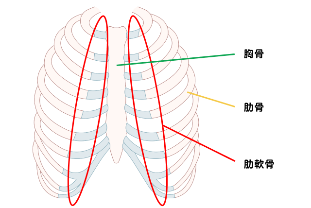 肋軟骨炎とはどのような病気ですか？ ｜肋軟骨炎