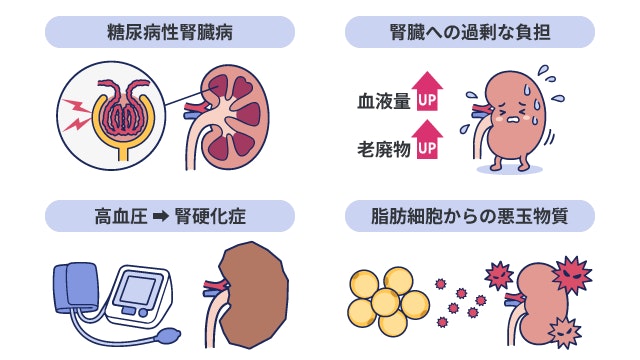 肥満症が腎臓病を引き起こす原因が、糖尿病や高血圧による影響、血液量増加等による腎臓への過剰な負担、および脂肪細胞から分泌される悪玉物質によるダメージであることを示したイラストです。